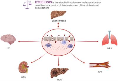 Liver cirrhosis and complications from the perspective of dysbiosis